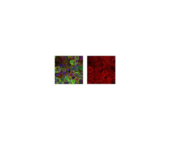 62-8458-33　反VAMP-3　ABC464