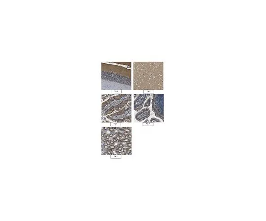 62-8466-26　抗巴松抗体　ABN255