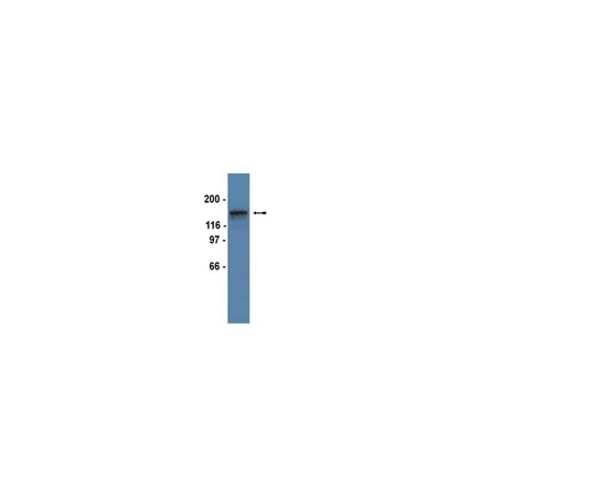 62-8368-78　抗PDGFRβ，克隆4A56;100μL　04-825