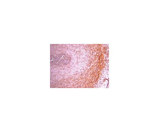 62-8444-53　抗前胶原III型PIIINP;100μg　AB764P