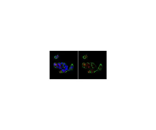 62-8456-31　Anti-Bax (N末端);100μg　ABC11