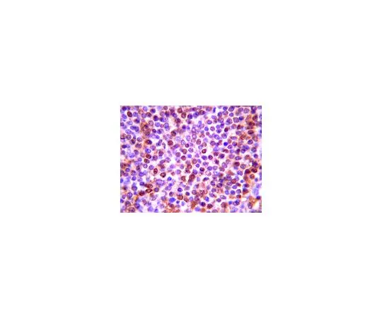 62-8446-64　抗LCN2;100μg　AB2267