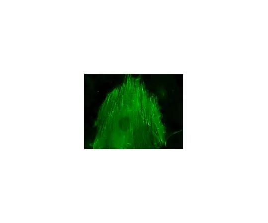 62-8394-39　慢Brite (TM) α-肌动蛋白-GFP慢病毒生物传感器　17-10156