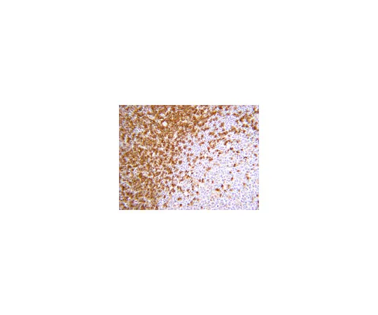 62-8374-86　抗CD45RA,克隆MEM 56;100μg　05-1413