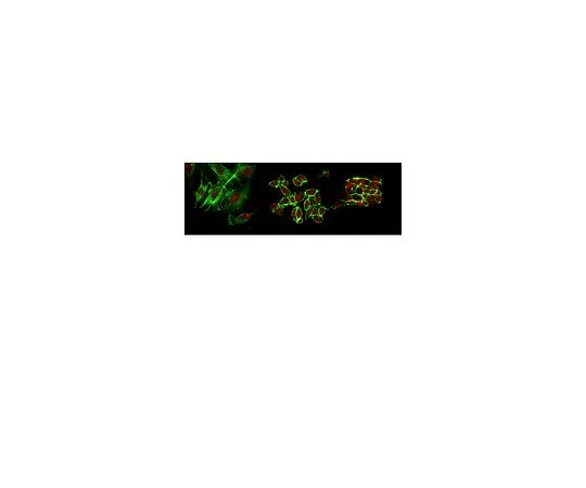 62-8388-47　抗DNMT3A2;100μg　7-50