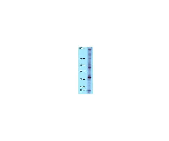 62-8392-79　抗磷酸酪氨酸，4G10R铂，HRP共轭;100μL　16-316