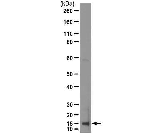 62-8444-92　抗白细胞介素-1β　AB1413-I