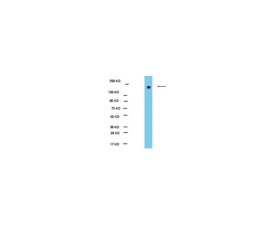62-8389-25　抗EHMT1/GLP1;100μg　09-078