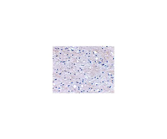 62-8466-78　抗BRAL1　ABN349