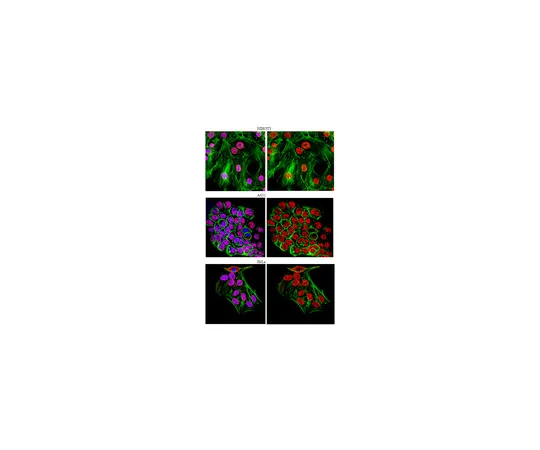 62-8375-44　抗U1-70K,克隆9C4.1;100μg　05-1588