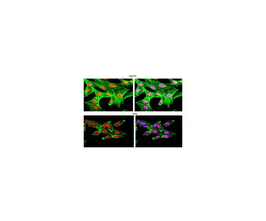 62-8385-29　反Hua;100μg　07-468