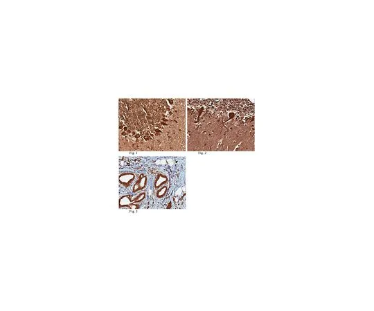 62-8456-68　Anti-Praf2 (JM4)　ABC95