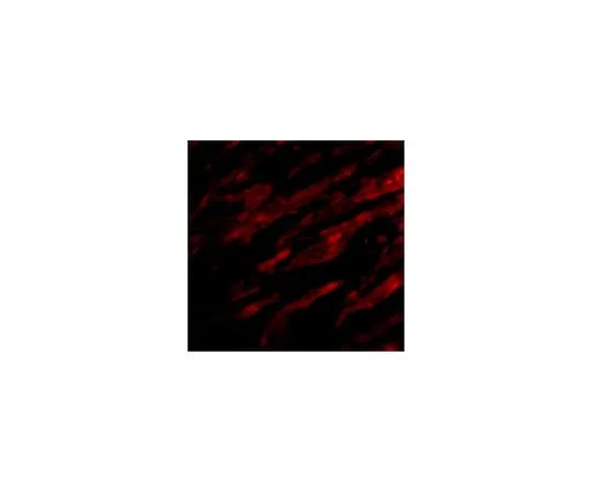 62-8457-62　抗PDL-1　ABC324