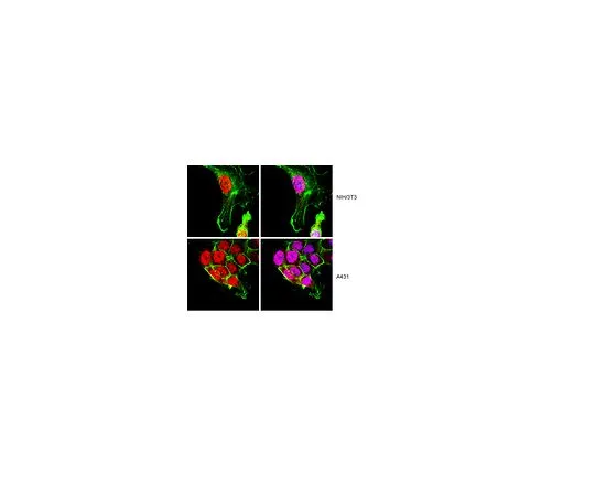 62-8388-29　抗FOO4;100μg　07-1720