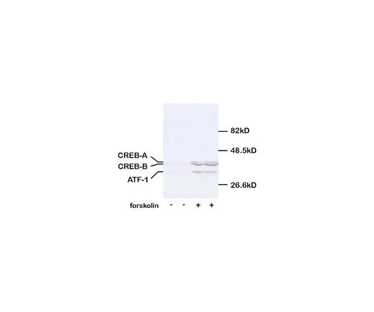 62-8447-82　反CREB,pSer133;100μL　AB3442