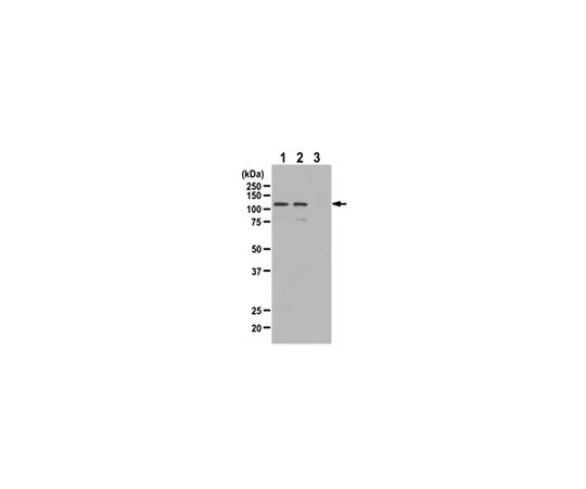 62-8385-45　抗磷-BMK1/Erk5 (Thr218/Tyr220);200μL　07-507