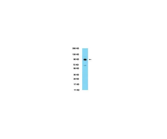 62-8446-38　防闭锁;100μL　AB2203
