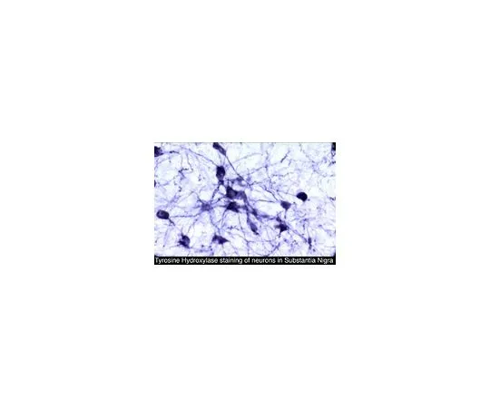 62-8452-15　抗酪氨酸羟化酶;50μL　AB5986