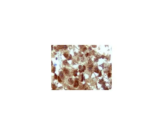 62-8456-35　反Attg4D;100μg　ABC22