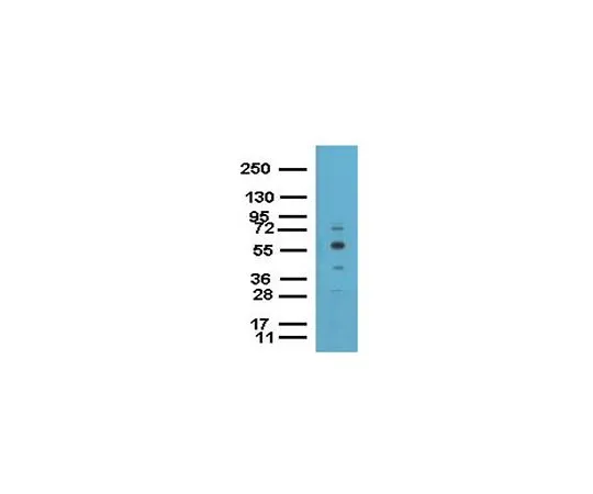 62-8393-95　ChIPAb+EED;25次检测　17-10034