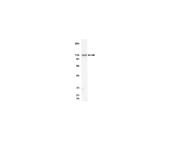62-8370-99　抗文克林，克隆V284;200μg　05-386