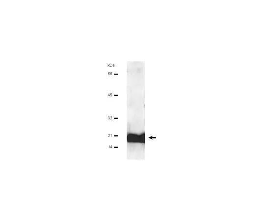 62-8370-52　抗钙调素;100μg　05-173