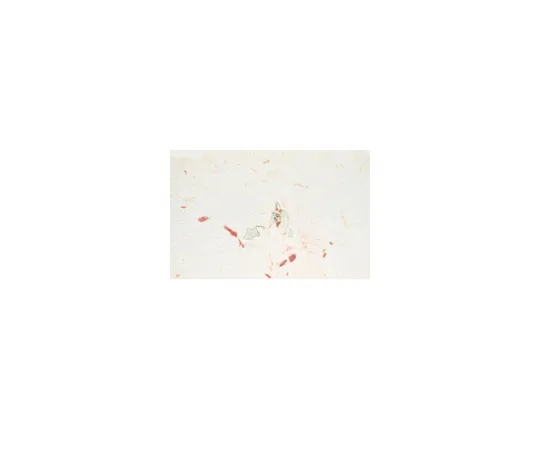62-8374-90　抗Endoglin,克隆P3D1;100μg　05-1424