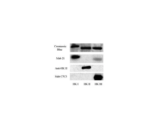 62-8447-66　抗Hexkinase II型;100μL　AB3279