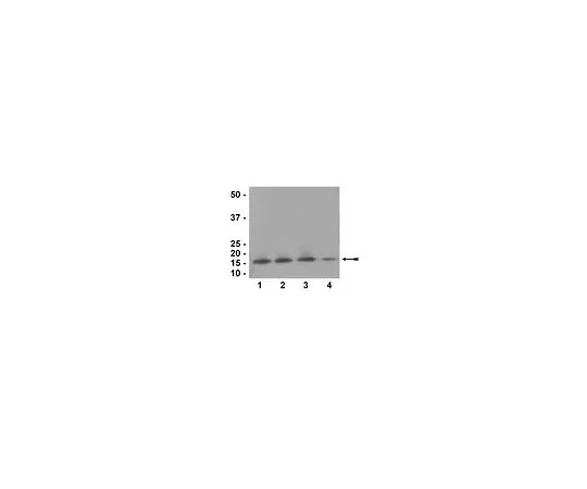 62-8386-26　抗组蛋白H3, CT,平底锅;100μL　07-690