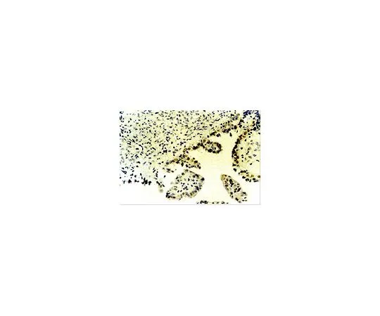 62-8452-52　抗p73,α和β;100μg　AB7824