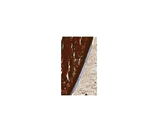 62-8466-04　抗αB微晶;100μg　ABN185