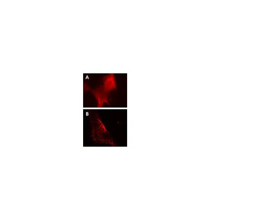 62-8394-90　慢Brite (TM) RFP-p62慢病毒生物传感器　17-10404