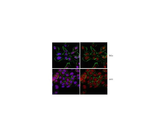 62-8382-73　反轴-1;100μg　06-1049