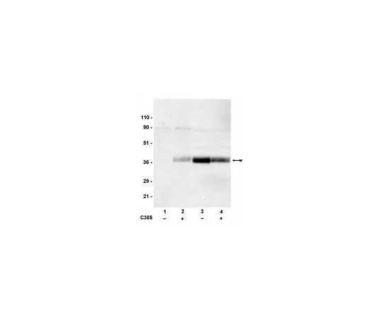 62-8384-31　抗磷LAT (Tyr191);200μg　07-278