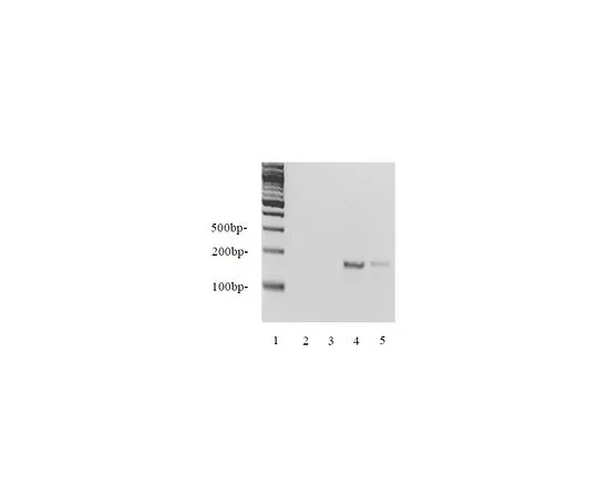 62-8393-33　EZ-Zyme (TM) 染色质准备套件;1个套件　17-375