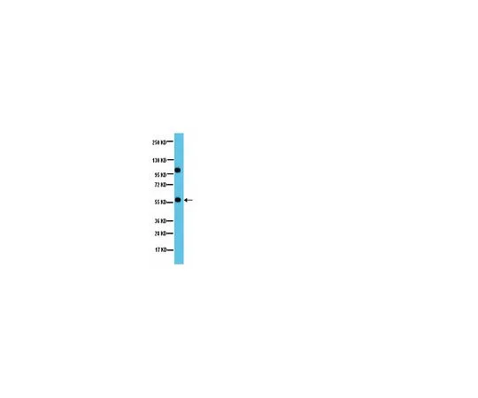 62-8387-22　抗PP2A-B’ (B56);100μg　07-1221