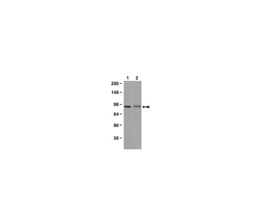 62-8368-99　抗Beta Catenin克隆7F7.2;100μg　04-958