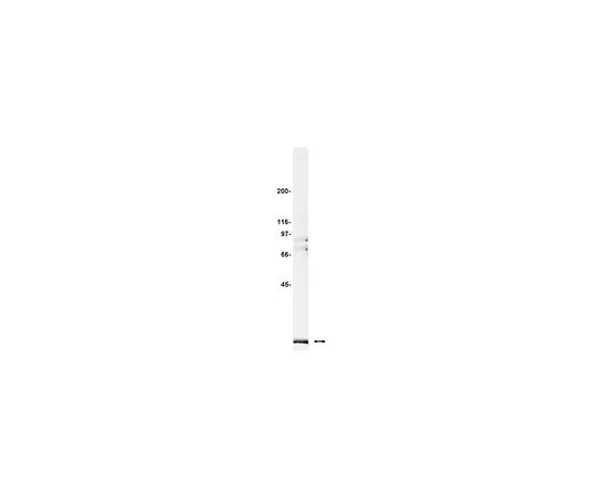 62-8383-68　反Pin1;100μg　07-091