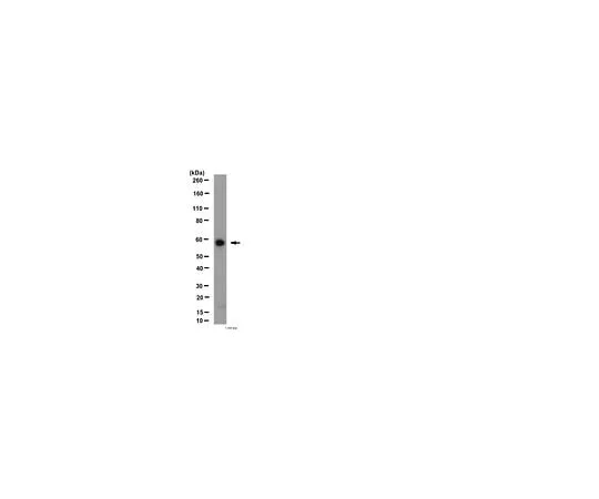 62-8454-45　抗血管生成素-1;100μg　AB10516