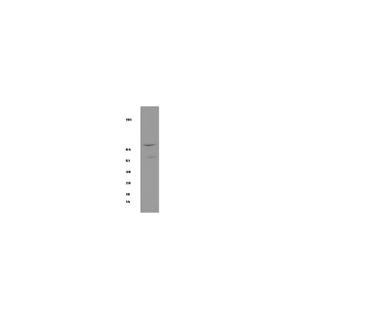 62-8371-64　抗IKKβ，克隆10AG2;100μg　05-535