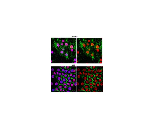 62-8375-51　抗三甲基组蛋白H3 (Lys27) ，克隆18E9.1;100μL　5-51
