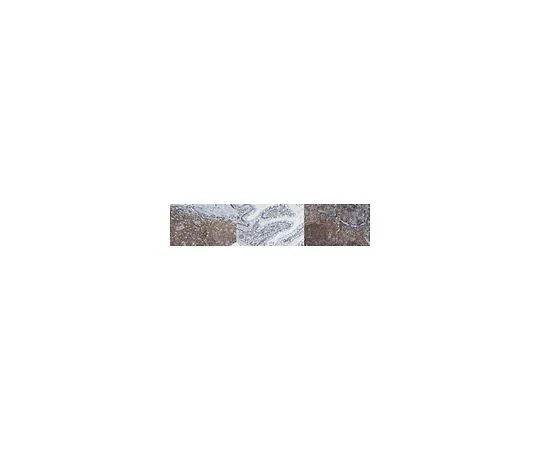 62-8385-88　抗Rac2抗体　07-604-I