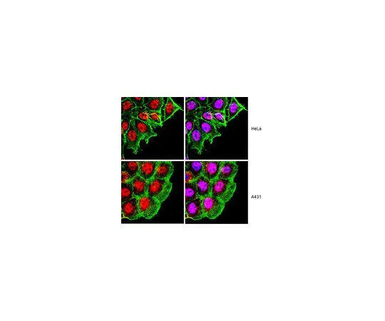 62-8388-31　反RAD50;100μg　07-1781