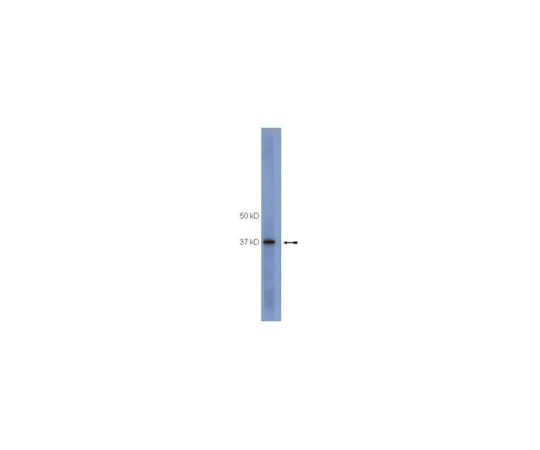 62-8367-81　抗SOCS1,克隆4H1;100μg　04-002