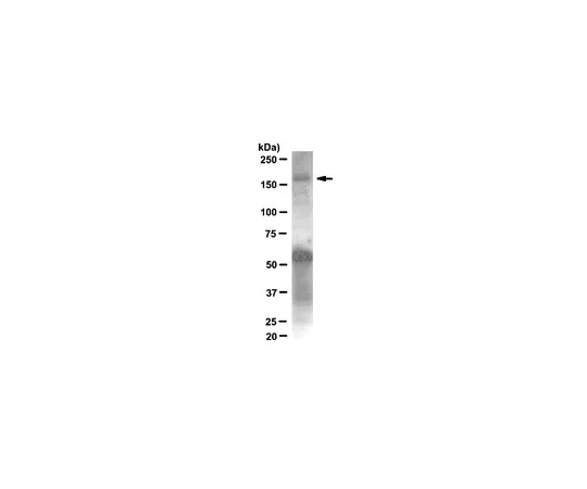 62-8372-94　抗IRS1,克隆58-10C-31;100μL　05-784R