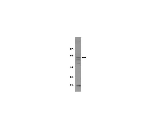 62-8381-31　反Myc;100μg　06-340
