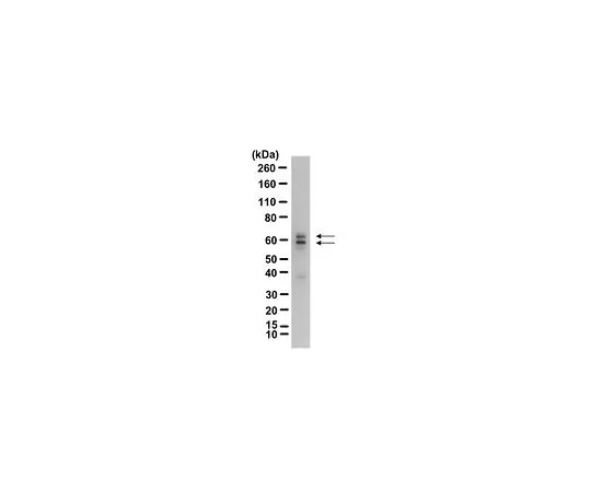 62-8465-77　抗GAD65;100μg　ABN101