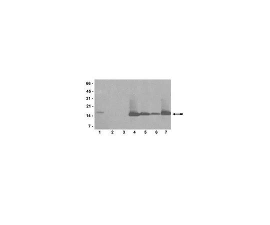 62-8368-67　抗二甲基-组蛋白H3 (Arg2) ，克隆20.2;200μL　04-808