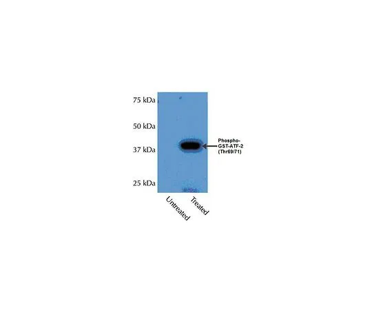 62-8389-57　抗磷-p38α (Thr180/Tyr182);100μL　09-272