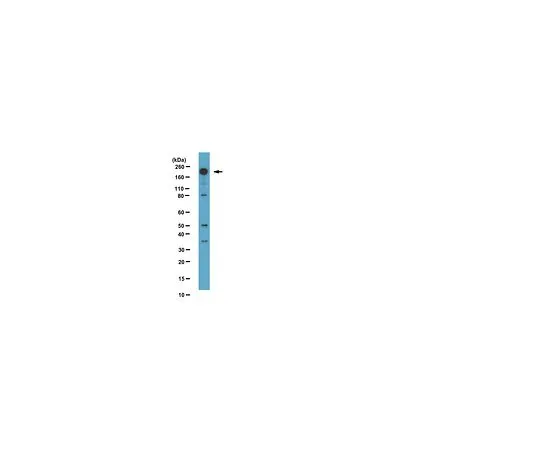 62-8388-18　抗磷-Dnmt1 (Ser714);100μg　07-1594